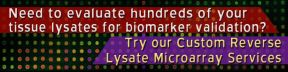 
      Need to evaluate hundreds of your tissue lysates for biomarker validation?
      Try our Custom Reverse Lysate Microarray Services.
    