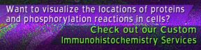 
      Want to visualize the location of proteins and phosphorylation reactions in cells?
      Check out our Custom Immunohistochemistry Services.
    