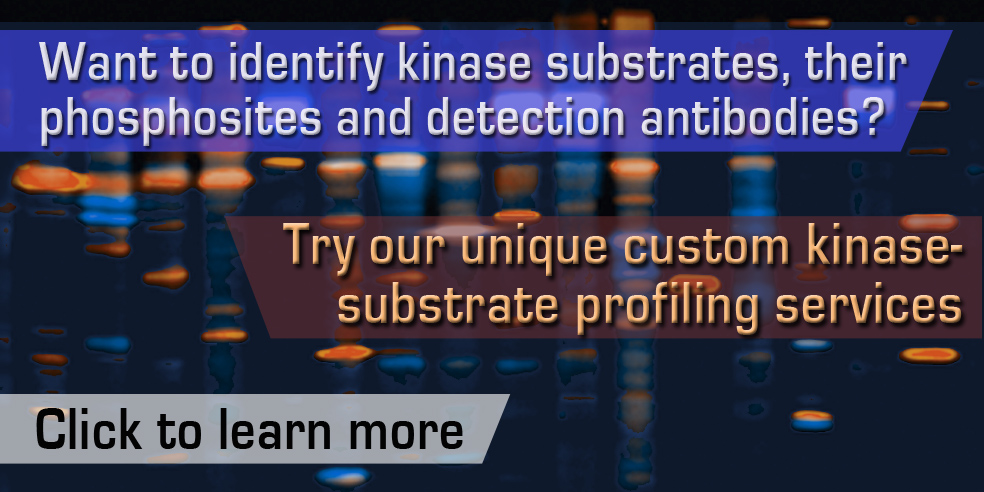 Transcriptonet